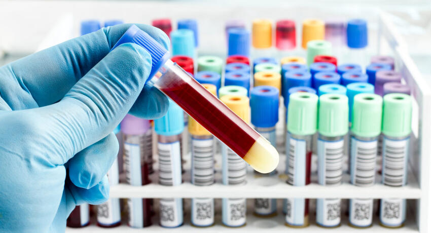 Биохимический анализ крови: расшифровка норма у взрослых